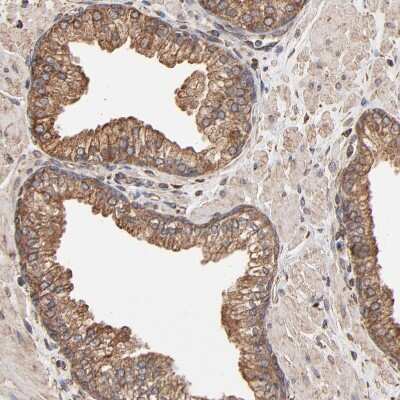Immunohistochemistry-Paraffin: ERp57/PDIA3 Antibody [NBP1-84797]