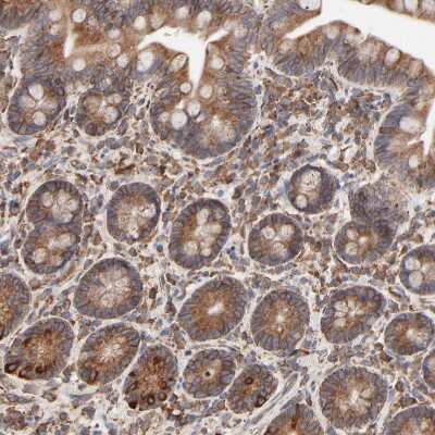 Immunohistochemistry-Paraffin: ERp57/PDIA3 Antibody [NBP1-84797]