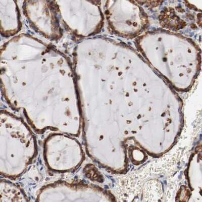 Immunohistochemistry-Paraffin: ERp57/PDIA3 Antibody [NBP1-84797]