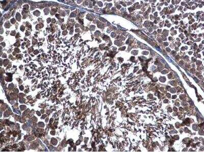 Immunohistochemistry-Paraffin: ERp57/PDIA3 Antibody [NBP2-16369]
