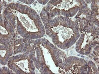 Immunohistochemistry: ERp57/PDIA3 Antibody (OTI3E1) - Azide and BSA Free [NBP2-70848]