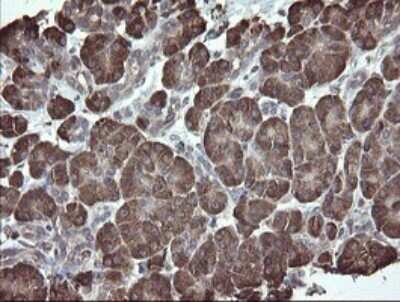 Immunohistochemistry: ERp57/PDIA3 Antibody (OTI3E1) - Azide and BSA Free [NBP2-70848]