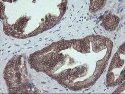 Immunohistochemistry: ERp57/PDIA3 Antibody (OTI3E1) - Azide and BSA Free [NBP2-70848]