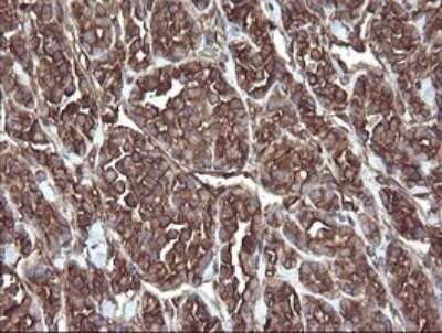 Immunohistochemistry: ERp57/PDIA3 Antibody (OTI4D7) - Azide and BSA Free [NBP2-70849]