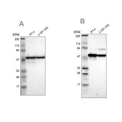 Western Blot: ERp57/PDIA3 Antibody [NBP1-84796]