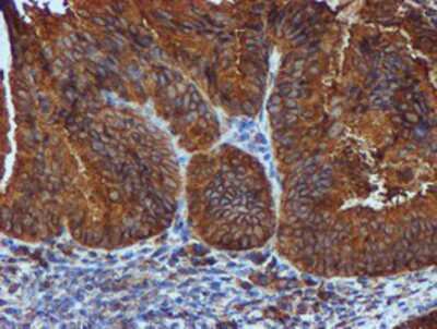 Immunohistochemistry-Paraffin: ERp72 Antibody (OTI2B9) [NBP2-01652]