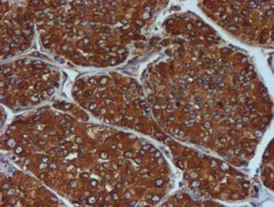 Immunohistochemistry-Paraffin: ERp72 Antibody (OTI2B9) [NBP2-01652]