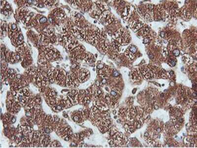 Immunohistochemistry-Paraffin: ERp72 Antibody (OTI2B9) [NBP2-01652]