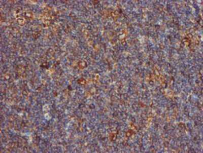 Immunohistochemistry-Paraffin: ERp72 Antibody (OTI2B9) [NBP2-01652]