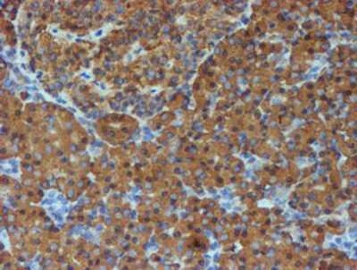 Immunohistochemistry-Paraffin: ERp72 Antibody (OTI2B9) [NBP2-01652]