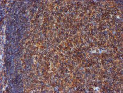 Immunohistochemistry-Paraffin: ERp72 Antibody (OTI2B9) [NBP2-01652]