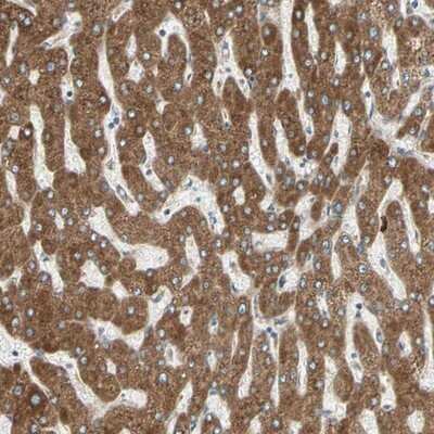 Immunohistochemistry-Paraffin: ERp72 Antibody [NBP1-84794]