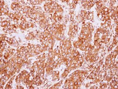 Immunohistochemistry-Paraffin: ERp72 Antibody [NBP2-16371]