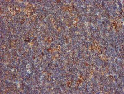 Immunohistochemistry: ERp72 Antibody (OTI2B9) - Azide and BSA Free [NBP2-71488]