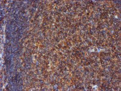 Immunohistochemistry: ERp72 Antibody (OTI2B9) - Azide and BSA Free [NBP2-71488]