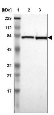 Western Blot: ERp72 Antibody [NBP1-84794]