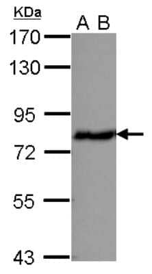 Western Blot: ERp72 Antibody [NBP2-16371]