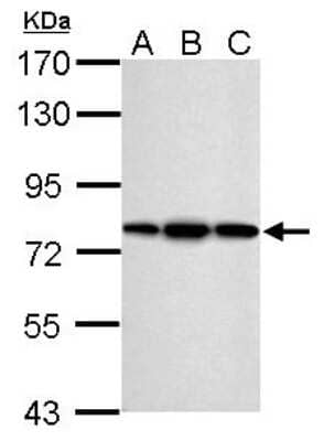 Western Blot: ERp72 Antibody [NBP2-16371]