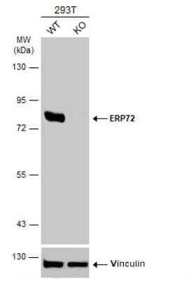 Western Blot: ERp72 Antibody [NBP2-16371]
