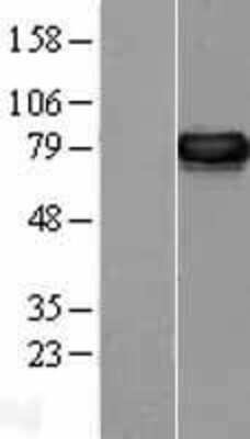 Western Blot: ERp72 Overexpression Lysate [NBL1-14245]