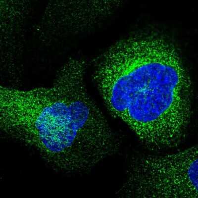 Immunocytochemistry/ Immunofluorescence: ESAM Antibody [NBP2-56089]