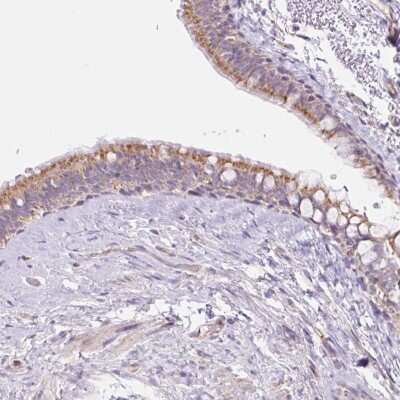 Immunohistochemistry-Paraffin: ESAM Antibody [NBP2-33780]