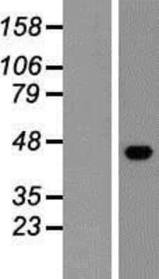 Western Blot: ESAM Overexpression Lysate [NBP2-05600]