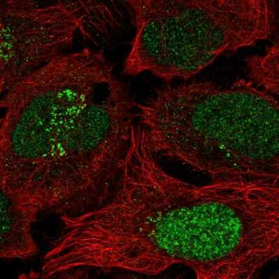 Immunocytochemistry/ Immunofluorescence: ESCO2 Antibody [NBP2-58532]