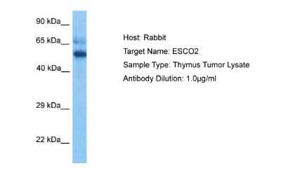 Western Blot: ESCO2 Antibody [NBP2-87372]