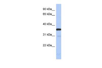 Western Blot: ESD Antibody [NBP1-57596]