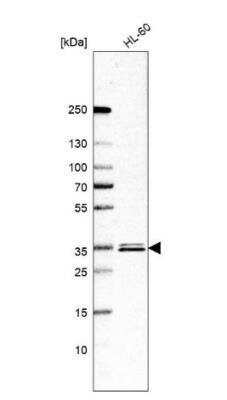 Western Blot: ESD Antibody [NBP1-89479]