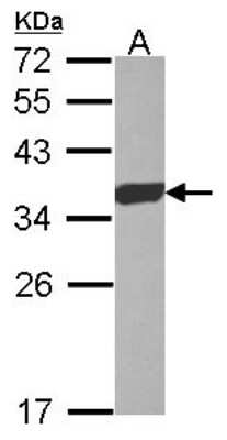 Western Blot: ESD Antibody [NBP2-16374]