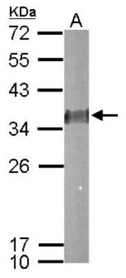 Western Blot: ESD Antibody [NBP2-16374]