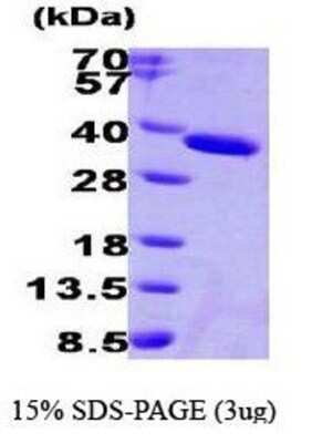 SDS-PAGE: Recombinant Human ESD His Protein [NBP1-30238]