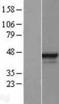 Western Blot: ELF3/ESE-1 Overexpression Lysate [NBL1-10230]