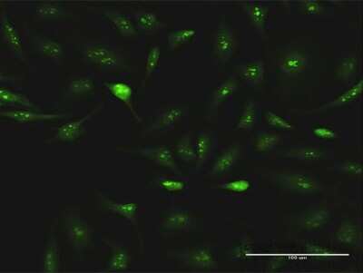 Immunocytochemistry/ Immunofluorescence: ESF1 Antibody [H00051575-D01P]
