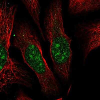 Immunocytochemistry/ Immunofluorescence: ESF1 Antibody [NBP2-58418]