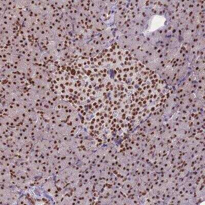 Immunohistochemistry-Paraffin: ESF1 Antibody [NBP2-13971]