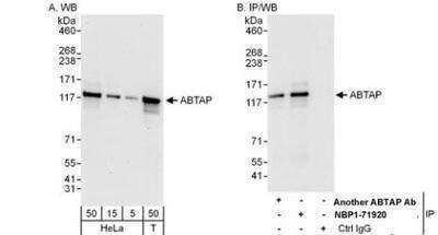 Immunoprecipitation: ESF1 Antibody [NBP1-71920]