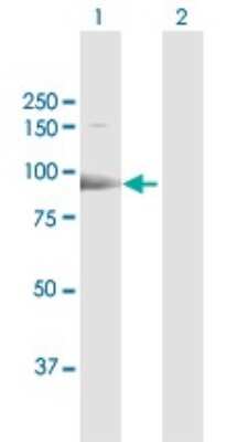 Western Blot: ESF1 Antibody [H00051575-D01P]