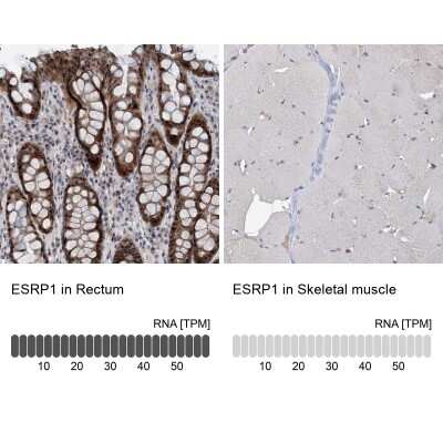 Immunohistochemistry-Paraffin: ESRP1 Antibody [NBP1-82202]