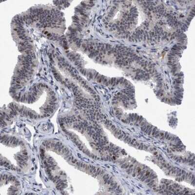 Immunohistochemistry-Paraffin: ESRP1 Antibody [NBP1-82202]