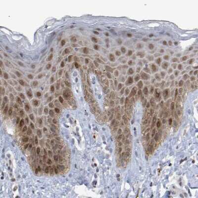 Immunohistochemistry-Paraffin: ESRP1 Antibody [NBP1-82202]