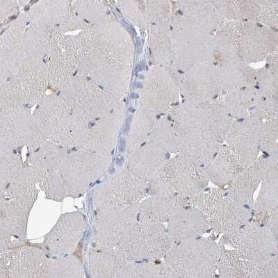 Immunohistochemistry-Paraffin: ESRP1 Antibody [NBP1-82202]