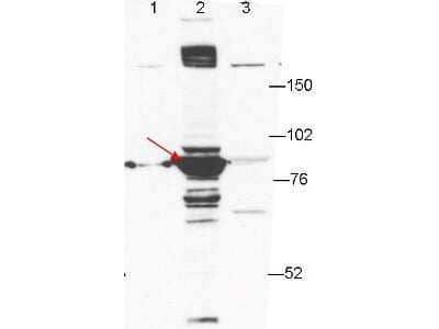 Western Blot: ESRP1 Antibody (27H12.F3.H5) [NBP1-42778]