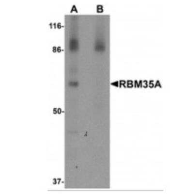 Western Blot: ESRP1 AntibodyBSA Free [NBP1-76536]