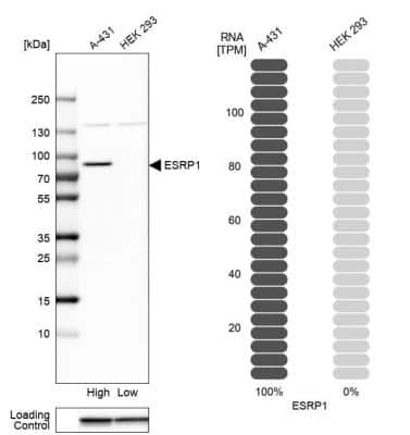 Western Blot: ESRP1 Antibody [NBP1-82202]