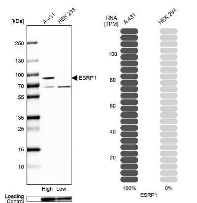 Western Blot: ESRP1 Antibody [NBP2-57822]