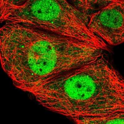 Immunocytochemistry/ Immunofluorescence: ESRP2 Antibody [NBP2-58259]