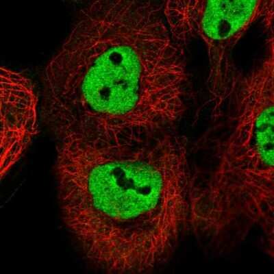 Immunocytochemistry/ Immunofluorescence: ESRP2 Antibody [NBP2-58852]